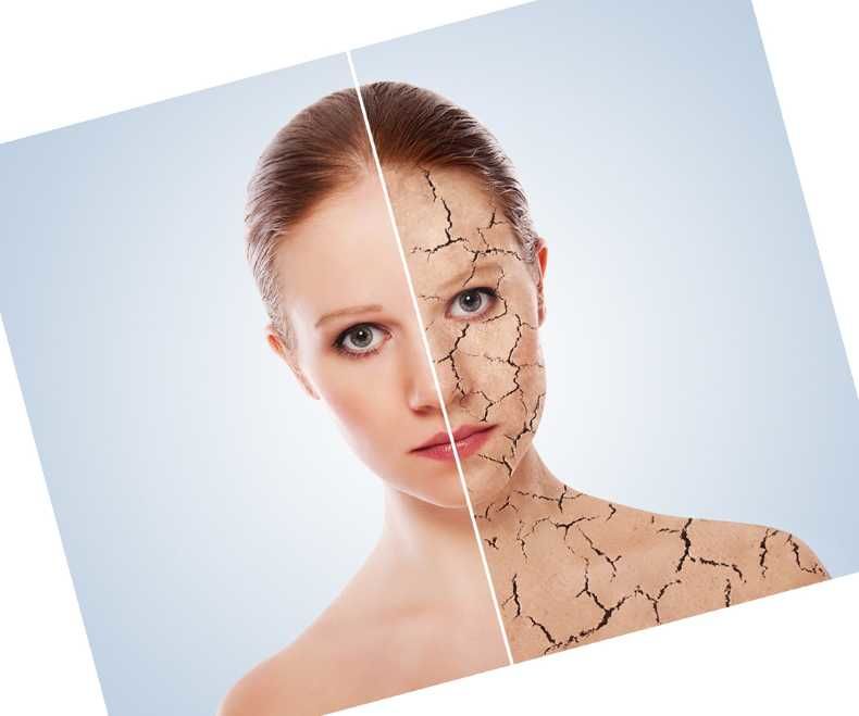 Psoriazisul poate afecta calitatea vieții. Cum îl tratezi alternativ?